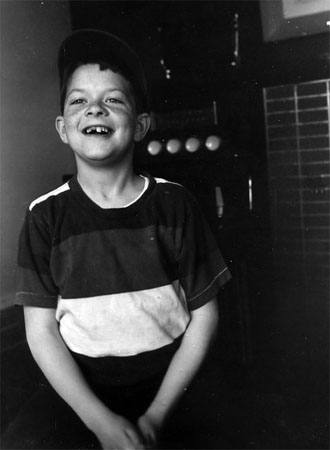 Colin-front-tooth
